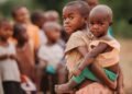 African Children suffering malnutrition